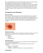 verzorgen van een darmstoma
