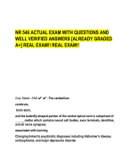 NR 546 ACTUAL EXAM WITH QUESTIONS AND  WELL VERIFIED ANSWERS [ALREADY GRADED  A+] REAL EXAM!! REAL EXAM!!