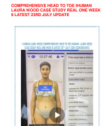 COMPREHENSIVE HEAD TO TOE IHUMAN LAURA WOOD, I HUMAN CYRUS HORTON CASE STUDY 57 YEAR OLD