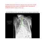 HUMAN CASE STUDY 376 Burns disaster chest tube Test 3 JACOB  ABRAHAM 58 YR OLD MALE CC BURNING CHEST DISCOMFORT  COMPLETE AND VE, Exams of Nursing