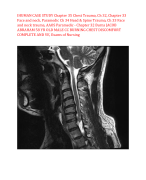 IHUMAN CASE STUDY Chapter 35 Chest Trauma, Ch 32, Chapter 33  Face and neck, Paramedic Ch 34 Head & Spine Trauma, Ch 33 Face  and neck trauma, AAOS Paramedic - Chapter 32 Burns JACOB  ABRAHAM 58 YR OLD MALE CC BURNING CHEST DISCOMFORT  COMPLETE AND VE, Exams of Nursing