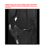 IHUMAN CASE STUDY EVITA ALONSO, 48YRS OLD FEMALE  HISPANIC AMERICAN FEMALE CCABDOMINAL PAIN, Exams  of Nursing