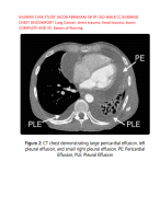 IHUMAN CASE STUDY JACOB ABRAHAM 58 YR OLD MALE CC BURNING  CHEST DISCOMFORT Lung Cancer, chest trauma, head trauma, burns COMPLETE AND VE, Exams of Nursing