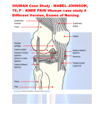 IHUMAN Case Study - MABEL JOHNSON,  76, F – KNEE PAIN iHuman case study 4  Different Version, Exams of Nursing