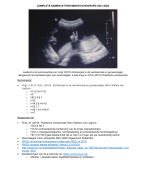 SAMENVATTING: Minor echografie. Verloskunde jaar 3, Verloskunde Academie Rotterdam (VAR).