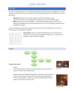 Volledige samenvatting low vision I gegeven door D. De Rijcke OOGZORG